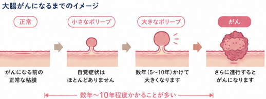 ポリープ