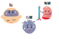 脳、腎臓、心臓が苦しんでいるイラスト