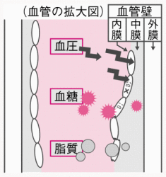 血管の中にある血管壁や血圧、血糖、脂質を表している拡大図のイラスト